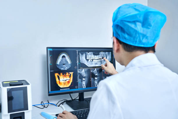 Best Emergency Wisdom Tooth Extraction in Three Rivers, OR